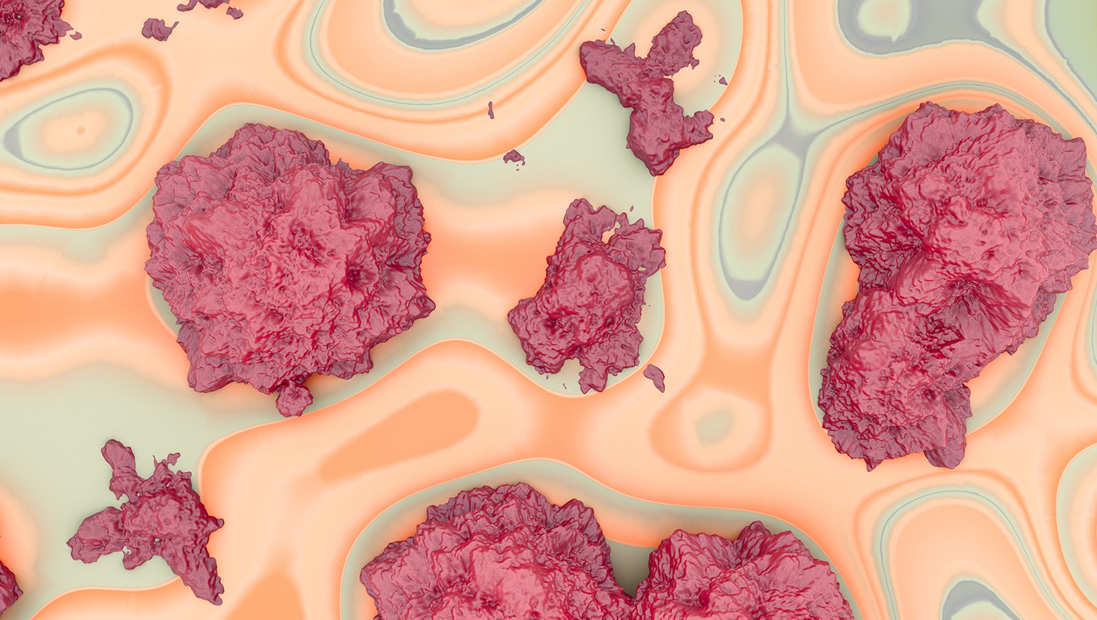Naświetlanie ograniczone do szpiku kostnego i narządów limfoidalnych (total marrow and lymphoid irradiation, TMLI) jako alternatywa dla napromieniania całego ciała (total body irradiation, TBI) u chorych z ostrą białaczką przygotowywanych do przeszczepienia hematopoetycznych komórek macierzystych