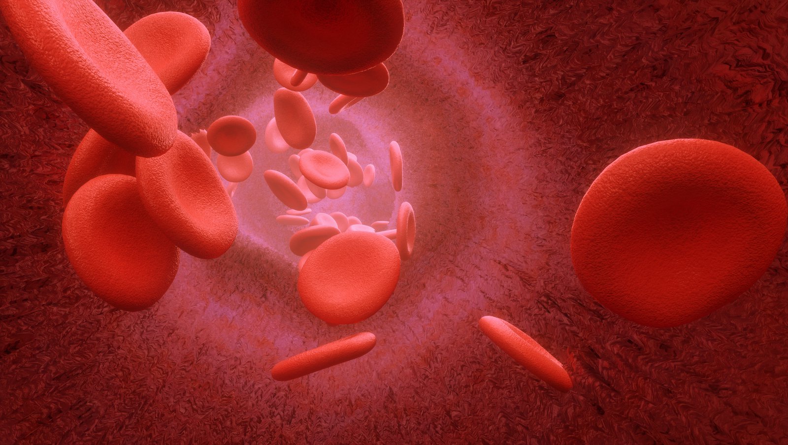 Nadpłytkowość u dzieci i młodzieży – klasyfikacja, diagnostyka i postępowanie kliniczne