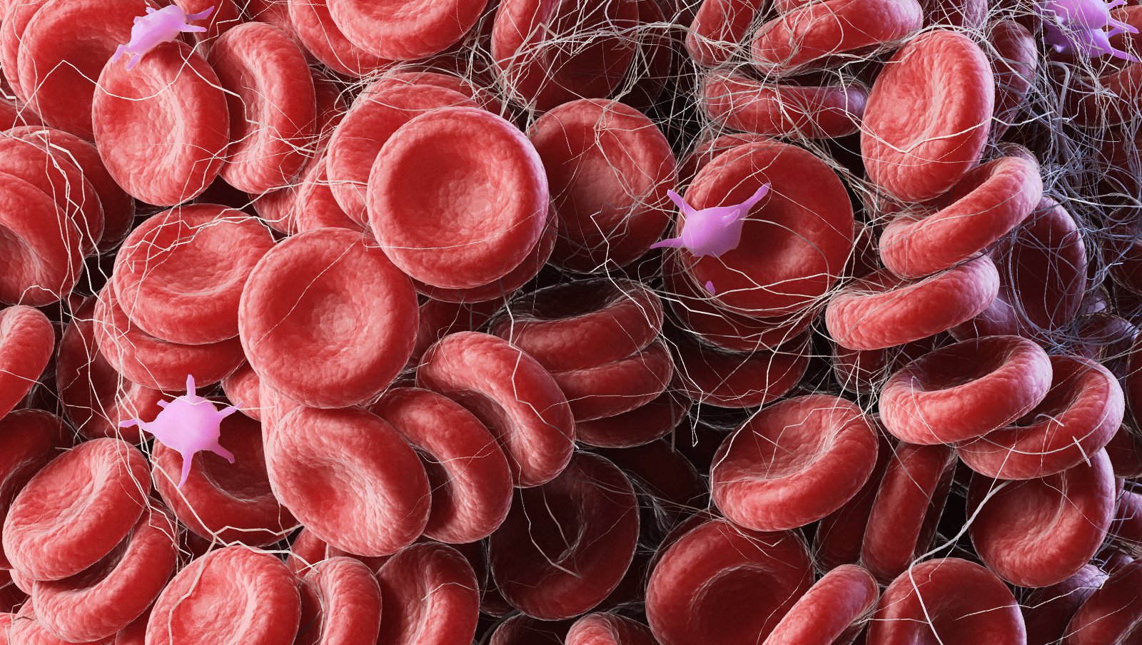 Emicizumab i zakrzepica: dotychczasowe doświadczenia