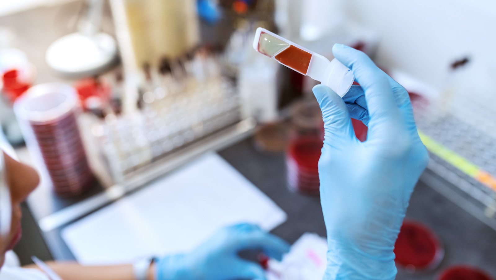 Badanie prospektywne dotyczące inhibitora w hemofilii u pacjentów dotychczas nieleczonych (Hemophilia Inhibitor PUP Study – HIPS) wskazuje na pojawianie się różnych przeciwciał przed rozwojem inhibitora do czynnika VIII