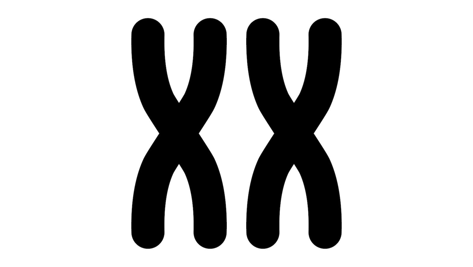 Strukturalne aberracje chromosomowe w ostrej białaczce szpikowej u dzieci