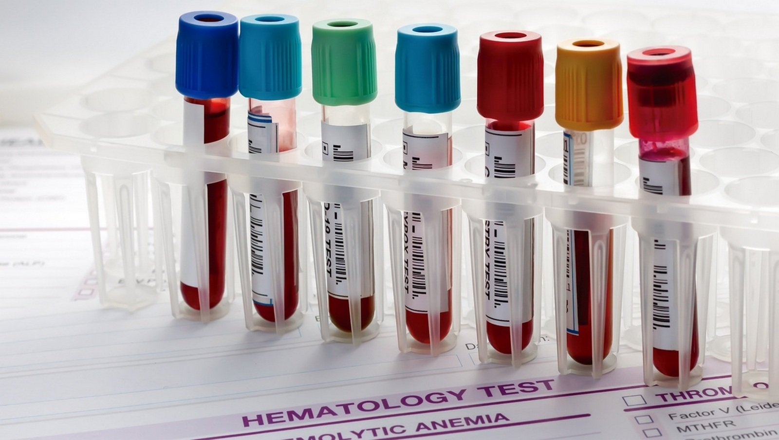Każdego roku ponad 1,2 mln osób na świecie otrzymuje diagnozę nowotworu krwi