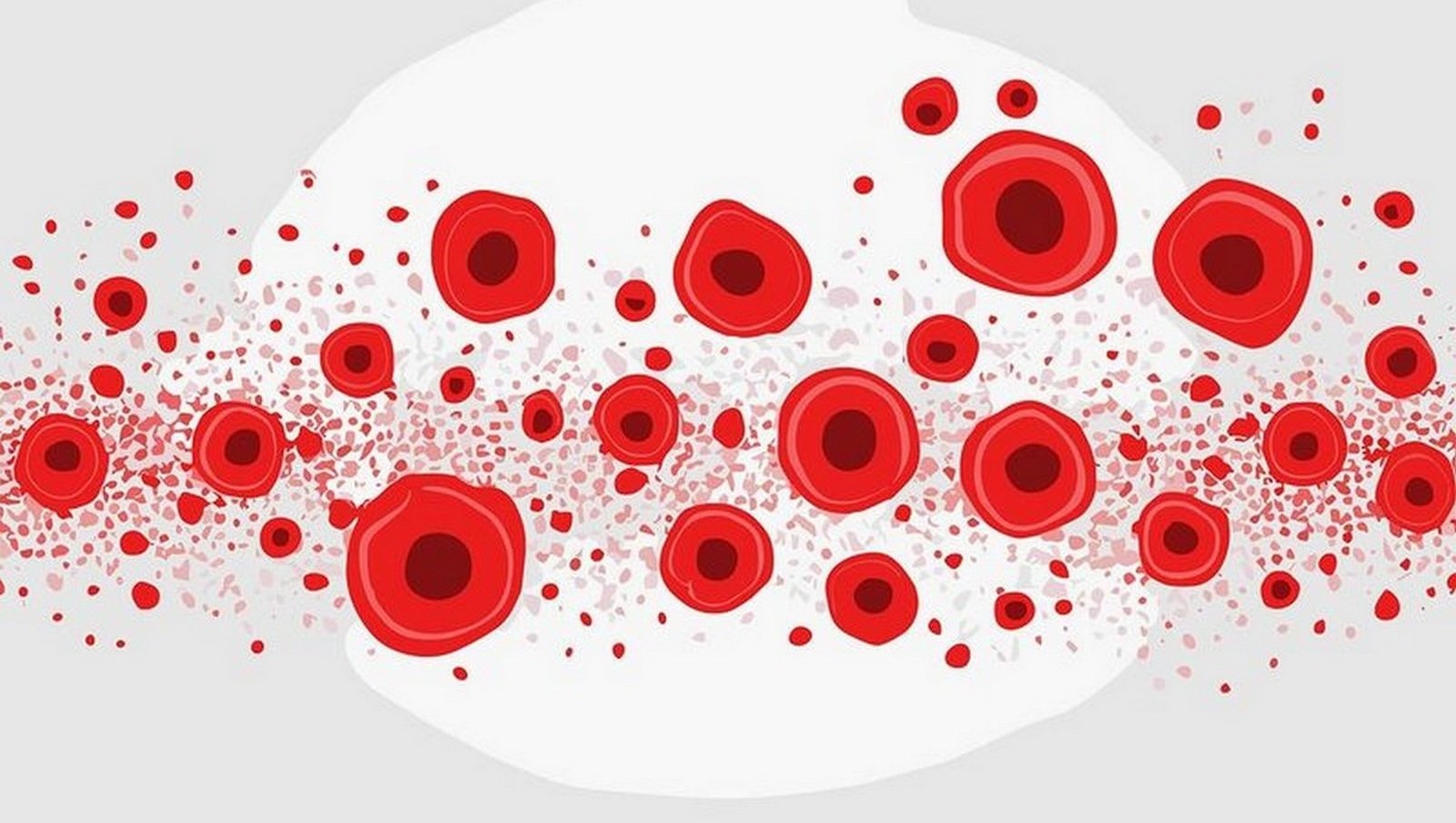 Leczenie hemofilii – wciąż jest wiele do zrobienia