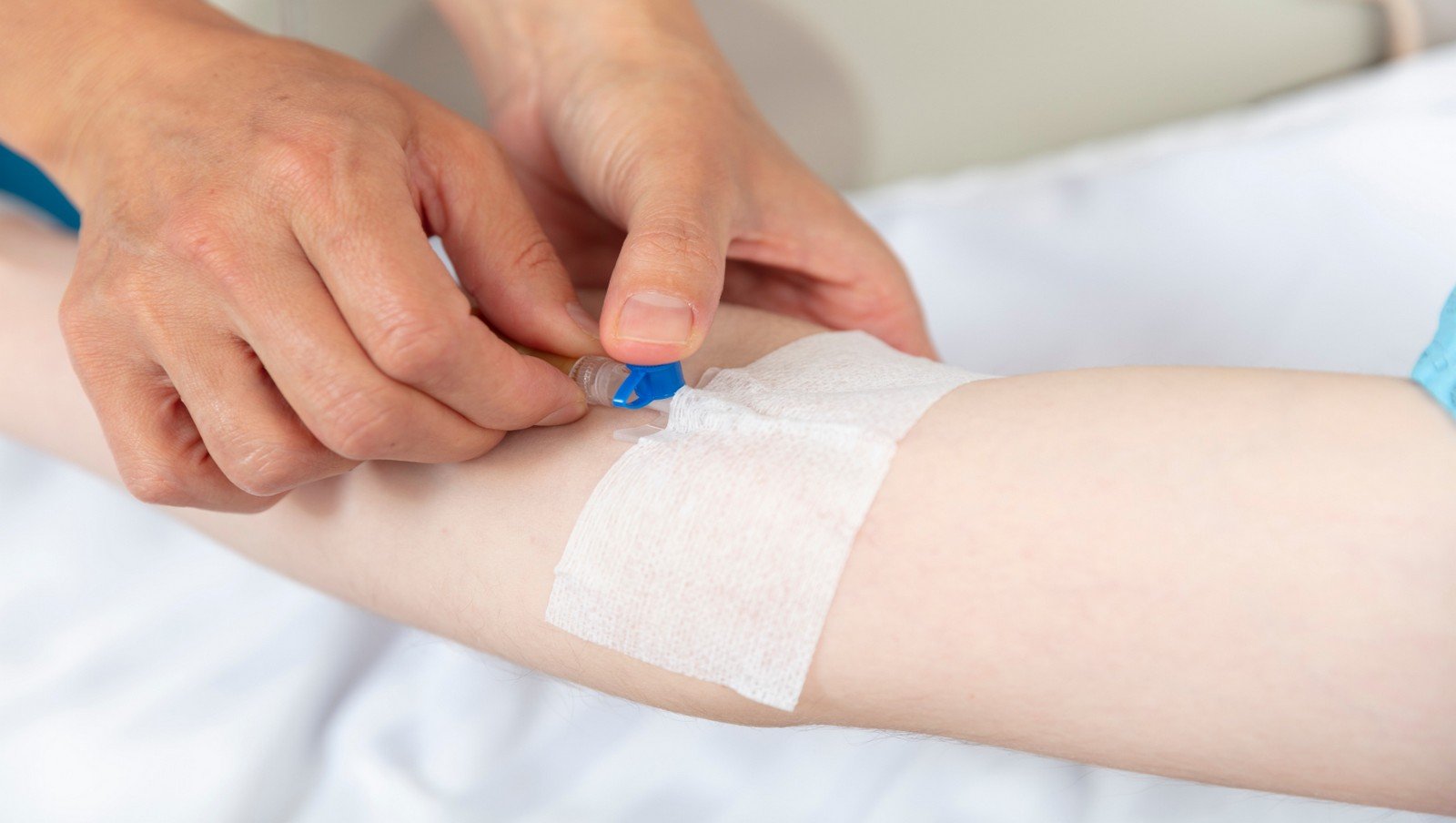 Powstaje druga część rekomendacji dotyczących bezpiecznego dostępu naczyniowego