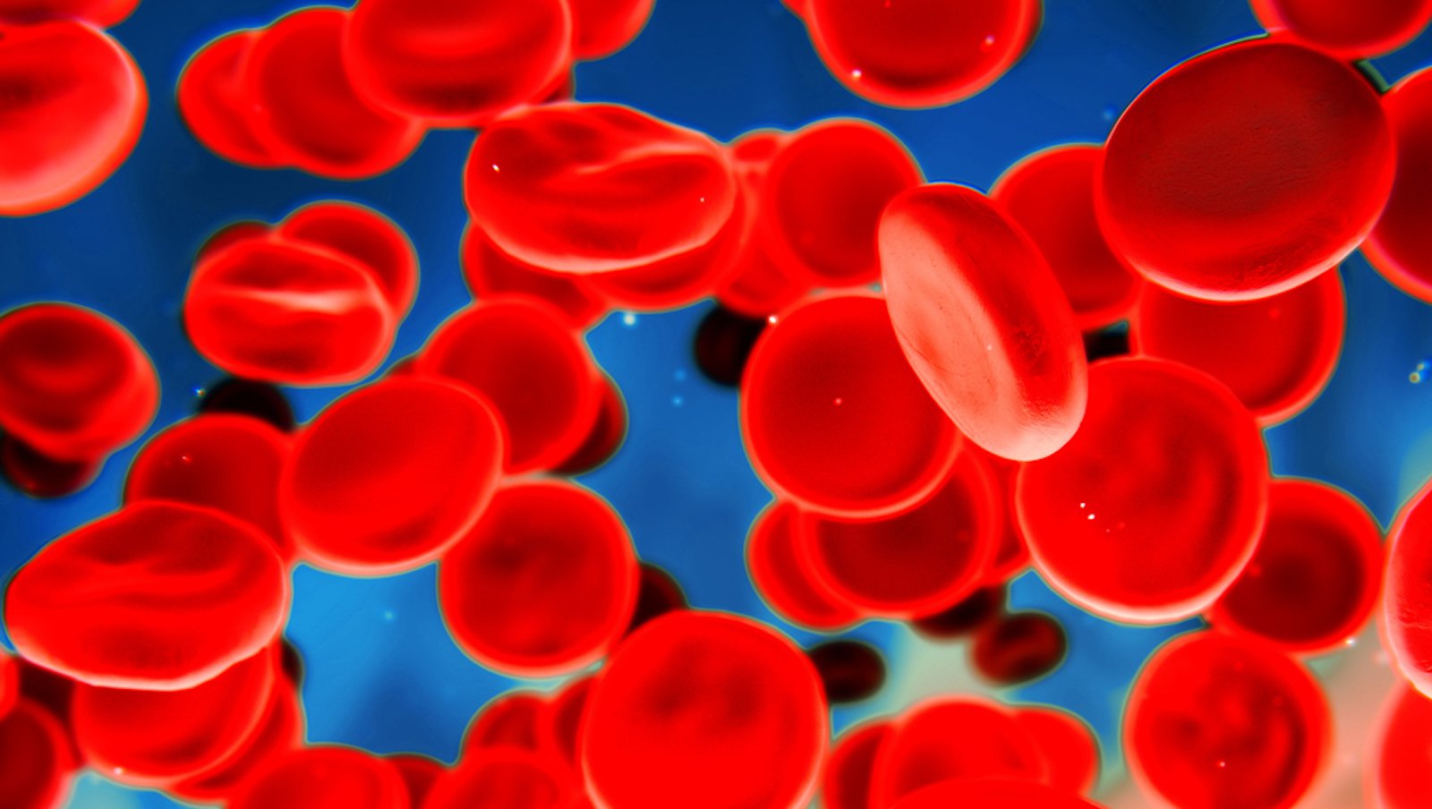 Jednoczesne stosowanie rFVIIa i emicizumabu u osób z hemofilią A powikłaną inhibitorem - aktualne perspektywy i nowe dowody kliniczne