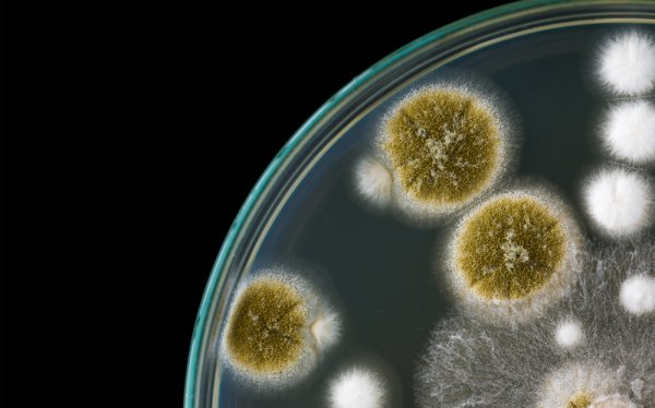 Inwazyjna mukormykoza u pacjentów pediatrycznych z rozpoznaniem choroby nowotworowej: retrospektywne badanie we Włoszech
