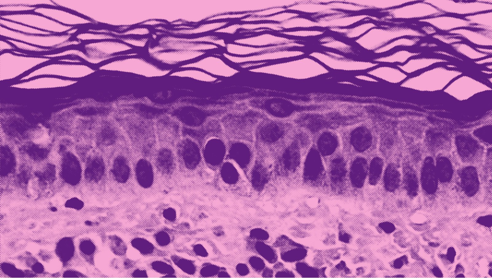 Mastocytoza – czyli co żyrafa ma wspólnego z hematologią? | 20 października – Międzynarodowy Dzień Mastocytozy i Chorób Komórek Tucznych