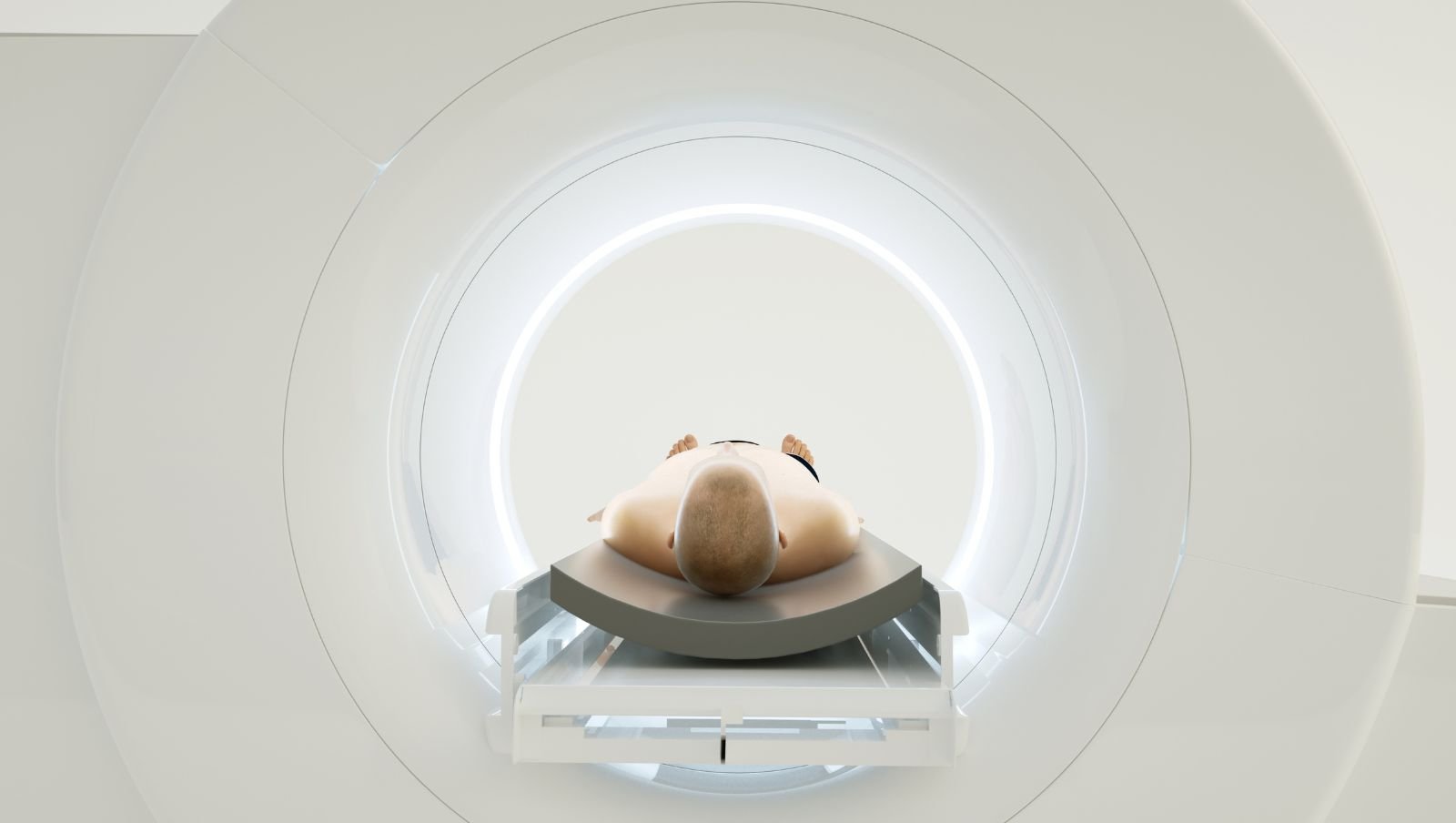Zwiększenie dostępności PET w diagnostyce onkologicznej. Są propozycje zmian w AOS