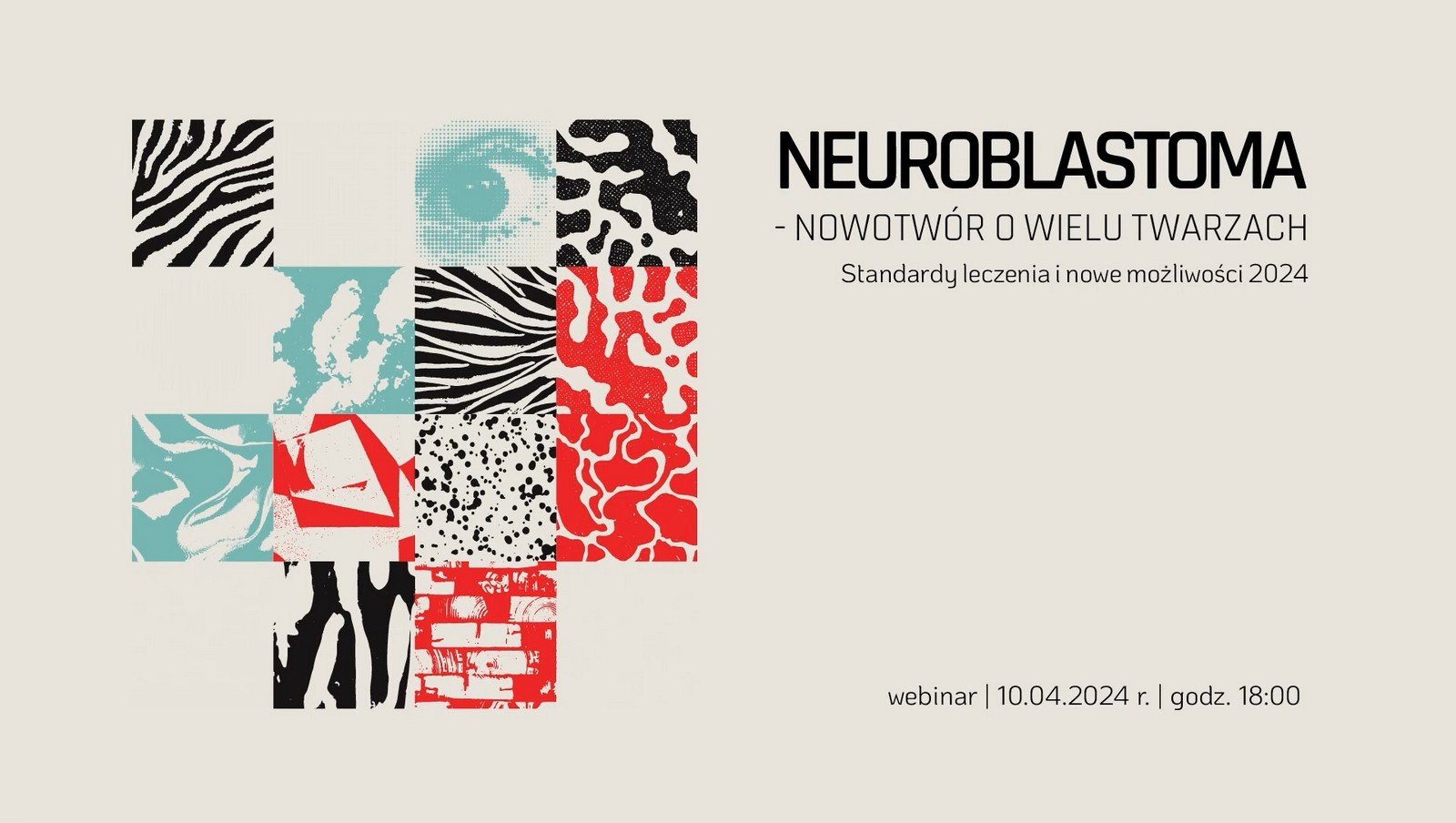 Neuroblastoma - nowotwór o wielu twarzach. Standardy leczenia i nowe możliwości 2024 | Nagranie webinaru
