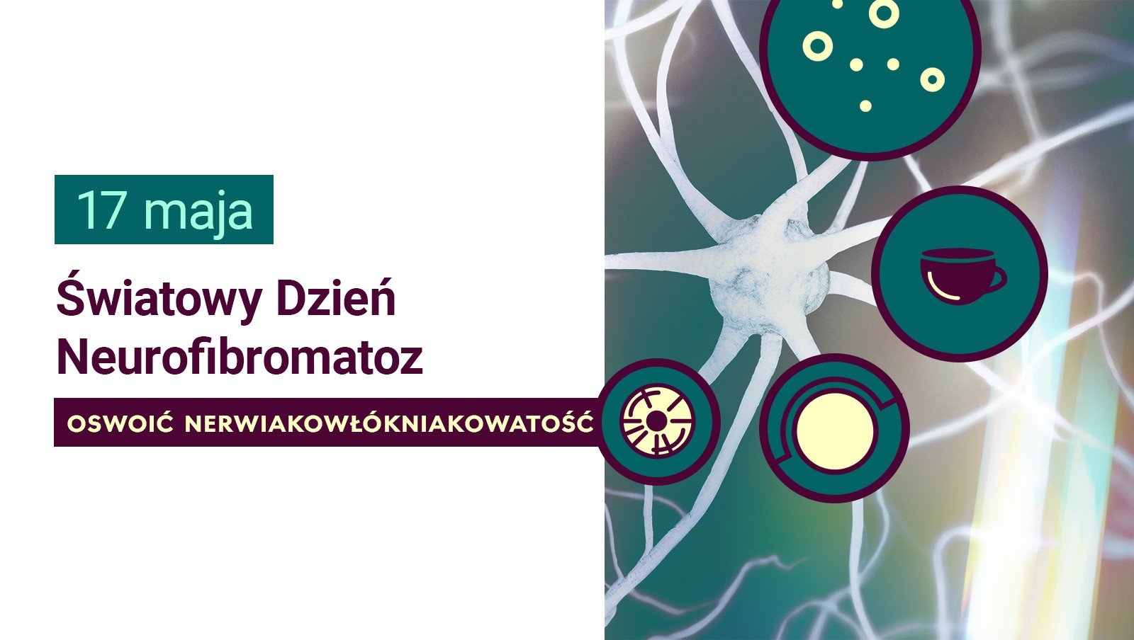 Oswoić nerwiakowłókniakowatość. Światowy Dzień Neurofibromatoz