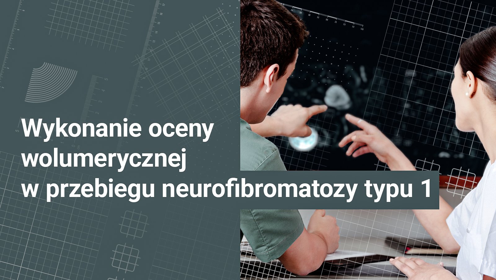 Wykonanie oceny wolumerycznej w przebiegu neurofibromatozy typu 1