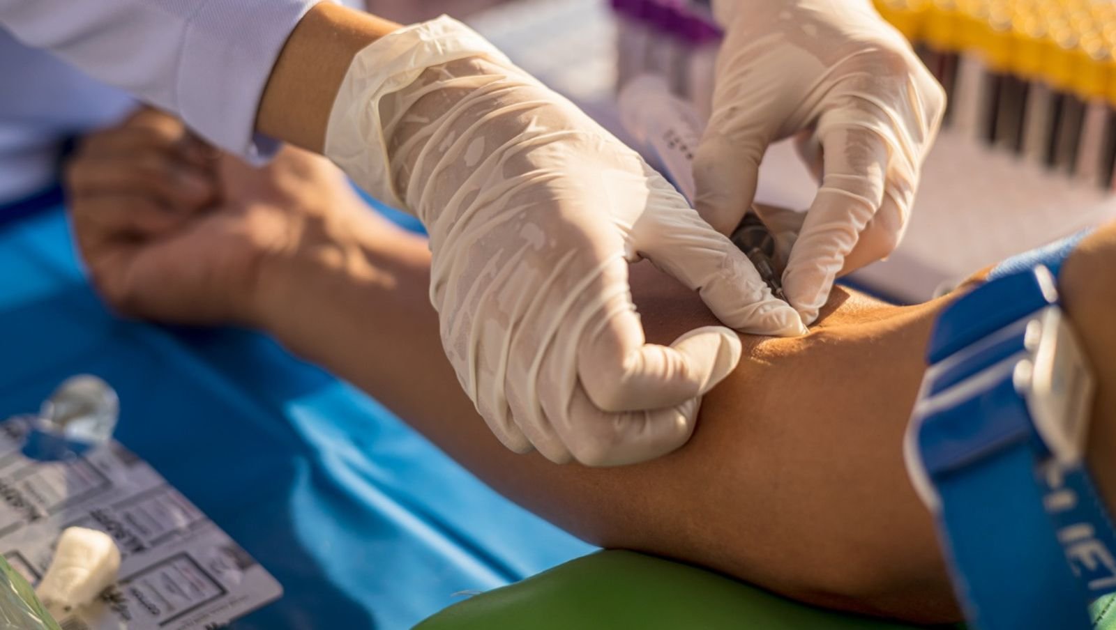 Badania laboratoryjne dla pacjentów, czyli co oznaczają podwyższone i obniżone krwinki czerwone (erytrocyty) w morfologii krwi?