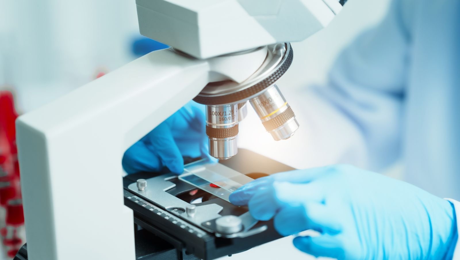 Terapia miejscowa mięsaka prążkowanokomórkowego pęcherza moczowego i/lub gruczołu krokowego bez przerzutów węzłowych oraz odległych w badaniu RMS2005