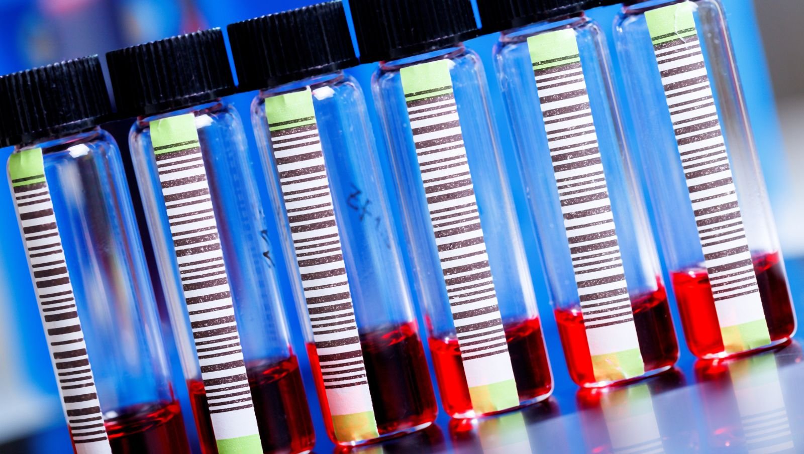 100 lat diagnostyki vWD: od testu kofaktora rystocetyny do badań genetycznych