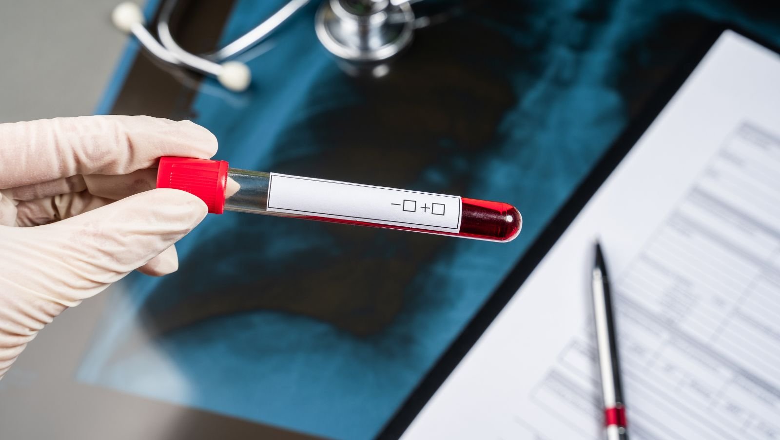 Choroba von Willebranda u kobiet: kiedy miesiączka i poród wymagają szczególnej ostrożności