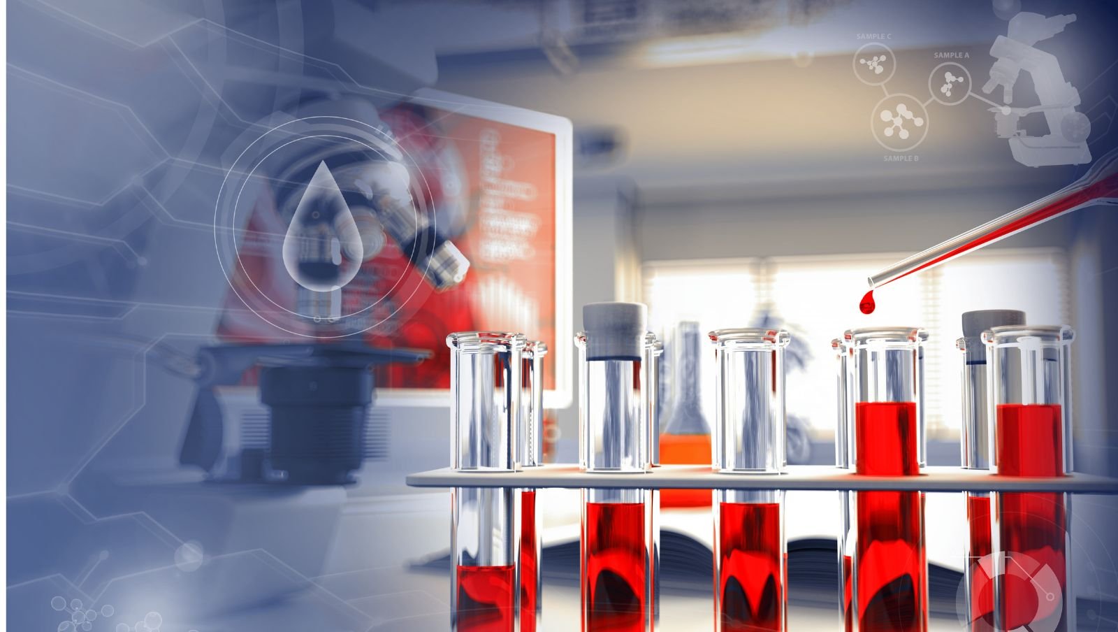 Rekomendacje PTOHD: Nowe podejście do immunotolerancji u dzieci z hemofilią A i inhibitorem czynnika VIII