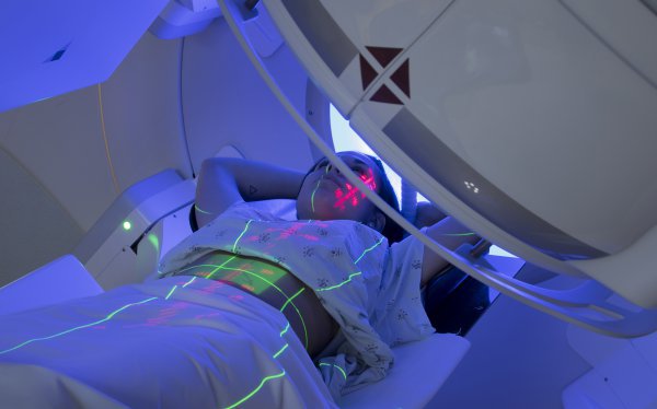 Radioterapia w leczeniu glejaków