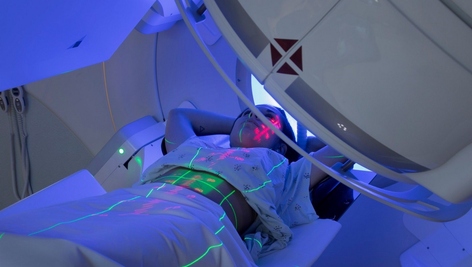 Jak wygląda radioterapia w leczeniu nowotworów dziecięcych?
