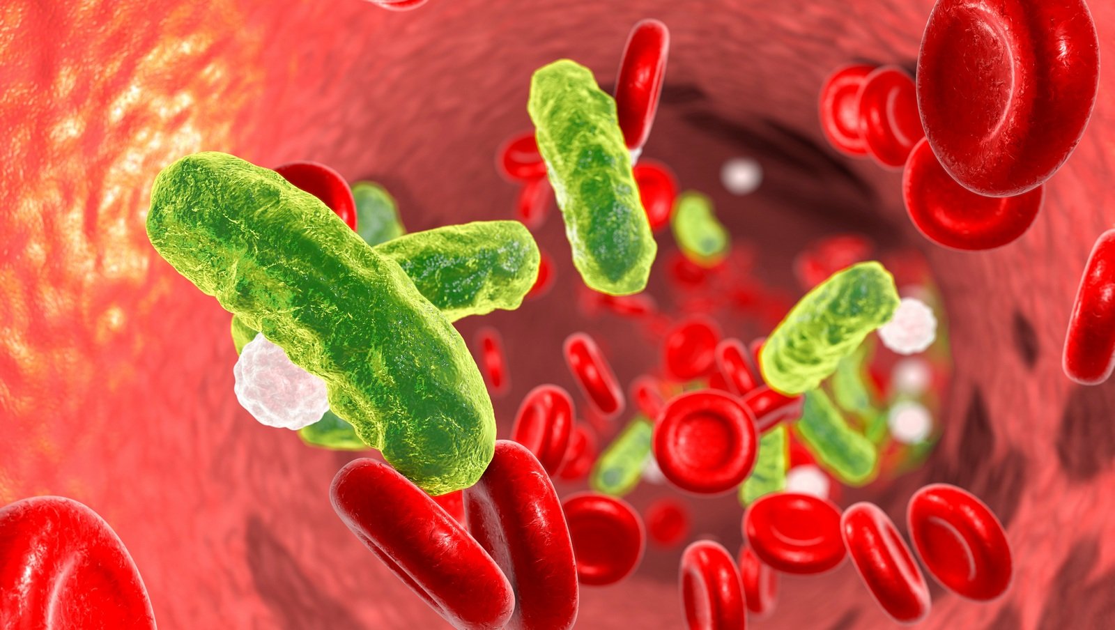 Global Sepsis Alliance ogłasza nową globalną strategię dla walki z sepsą