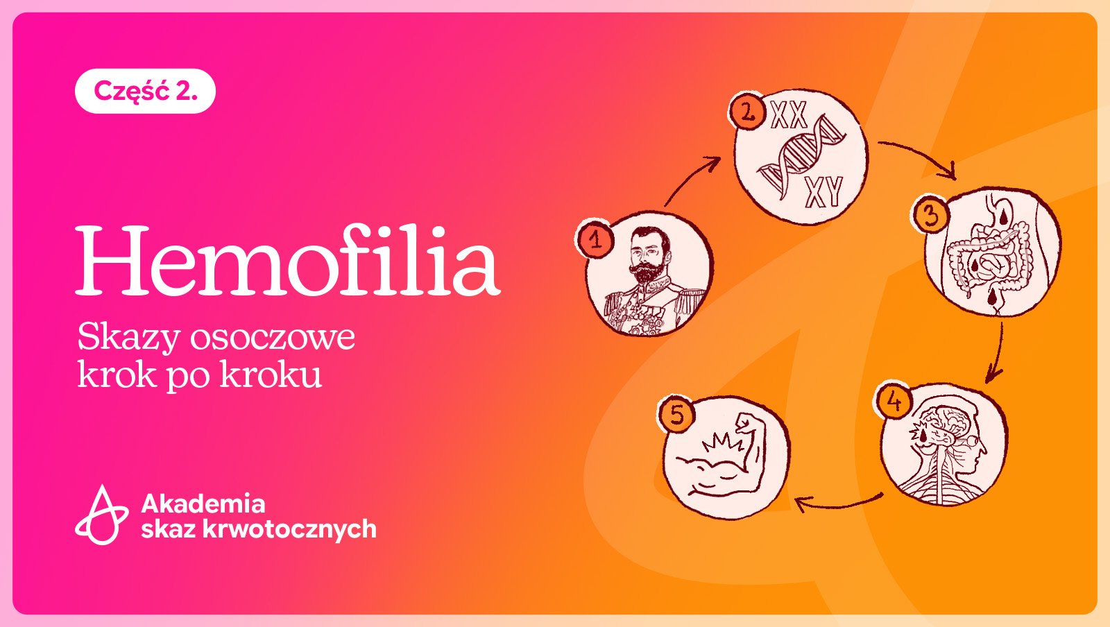 W Światowy Dzień Chorych na Hemofilię o hemofilii A i B. Skazy osoczowe krok po kroku | Cz. 2